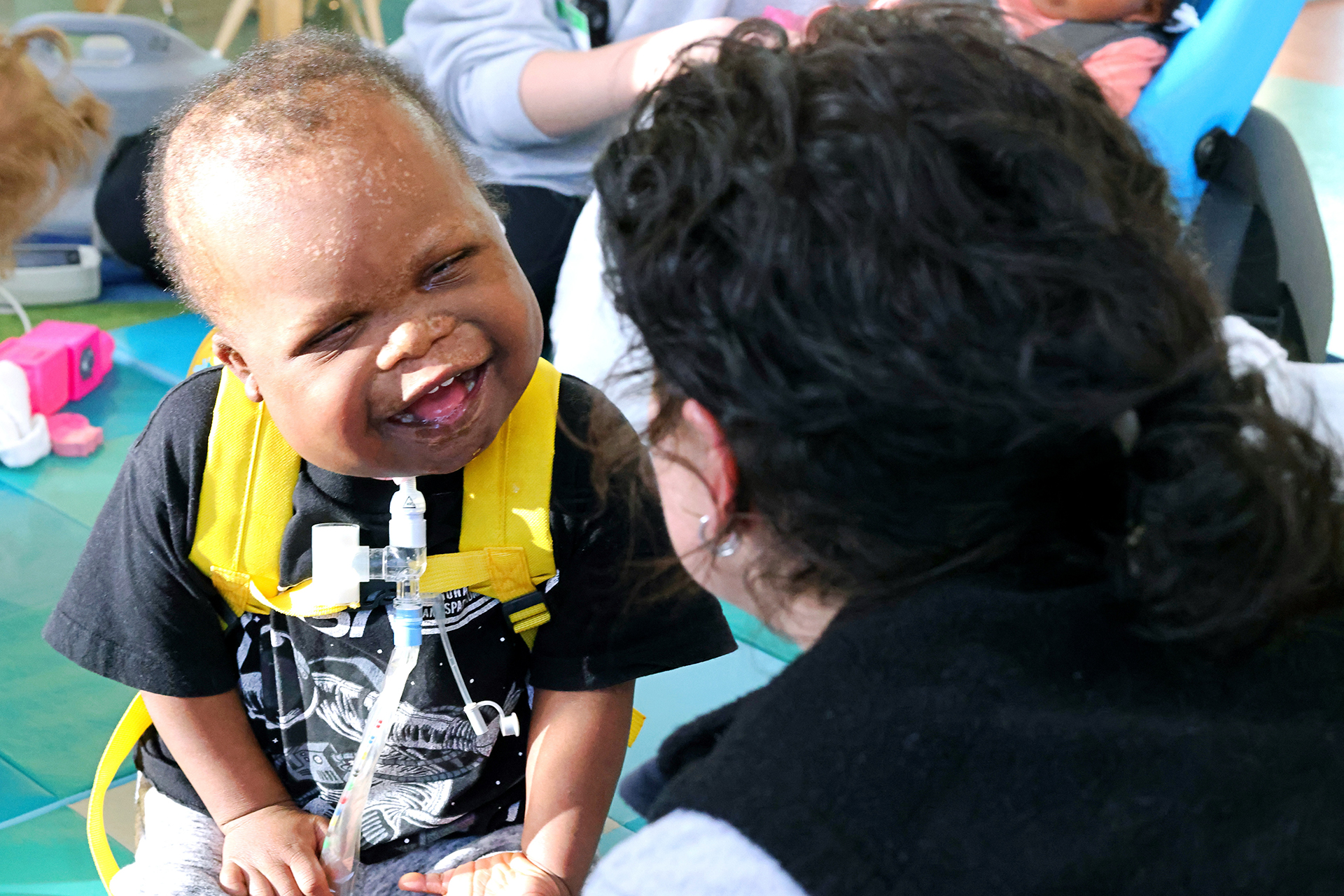 3. Patient Muaad Osman Mohamed, 2 years old