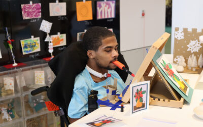 How Painting Helped a Teenager Heal Following a Horrible Accident