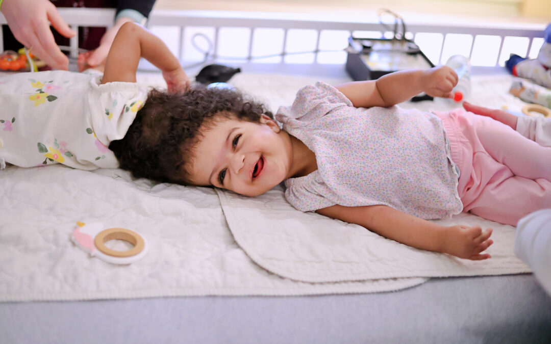 From Ethiopia to Ranken Jordan: The Incredible Journey and Recovery for Rare Conjoined Twins